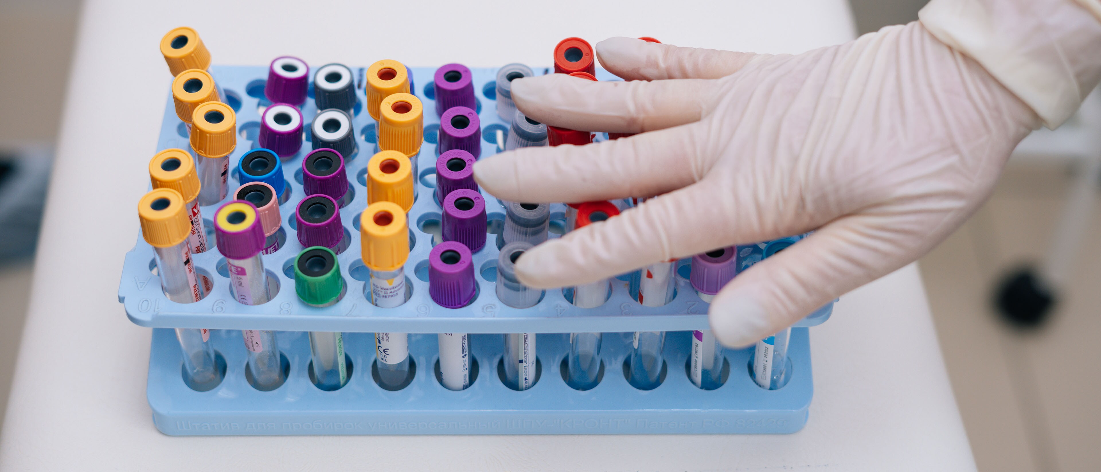 Medical-gloved hand hovering over purple and yellow capped vials for testing.